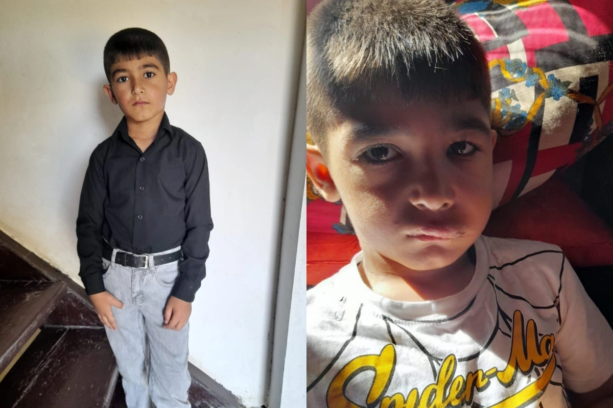 Yeddi yaşlı Yunis yenidən əməliyyat olunmalıdır: “Nə yemək yeyir, nə su içir”